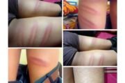 अधीक्षकाकडून विद्यार्थ्यांना चपलेने मारहाण